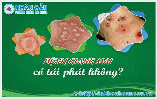 Bệnh giang mai có tái phát không?	