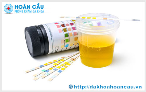 Các xét nghiệm khi mang thai cần thiết trong toàn bộ thai kỳ