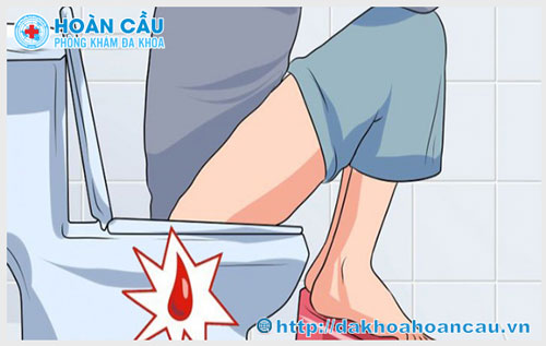 Đi cầu ra máu và đau rát hậu môn là dấu hiệu bệnh gì