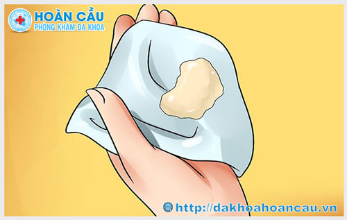 Huyết trắng màu vàng vón cục có sao không