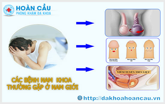 Tổng hợp các bệnh phụ khoa thường gặp ở nam giới