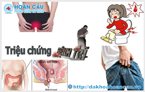 Phòng khám trĩ ở Cần Giờ tốt nhất 