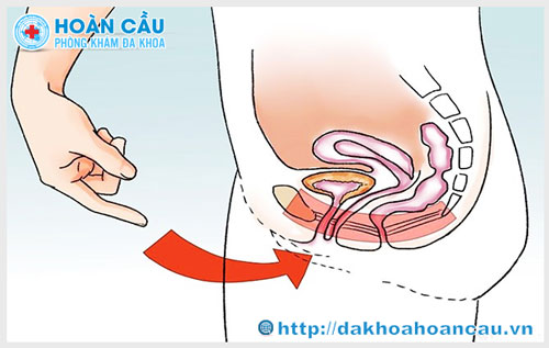 Xuất tinh nhưng không thấy tinh dịch là bị gì?