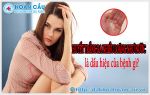 Khí hư ra nhiều loãng như nước