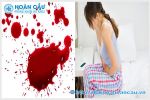 Nguyên nhân gây ra máu âm đạo nhiều