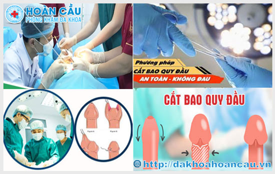 Phương pháp cắt hẹp bao quy đầu an toàn, không đau tại Hoàn Cầu