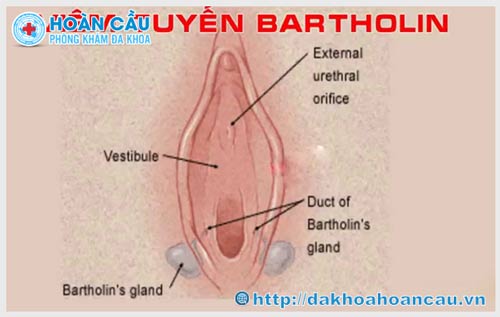 Viêm tuyến Bartholin là gì ?
